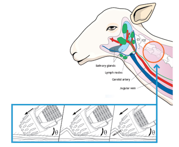 Glanvac vaccinator