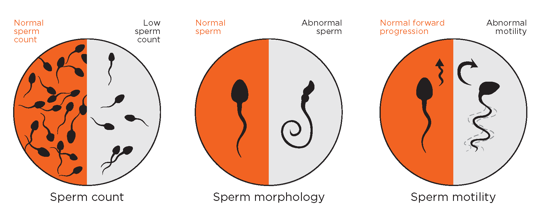 Sperm_Mobility_Diagram